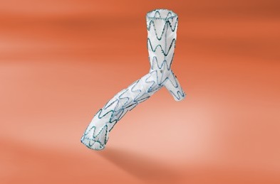 The E-liac Stent Graft System from Jotec